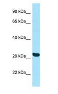 TBPL2 / TRF3 Antibody - TBPL2 / TRF3 antibody Western Blot of HepG2.  This image was taken for the unconjugated form of this product. Other forms have not been tested.