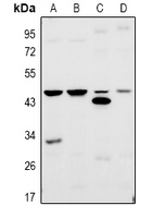 TBPL2 / TRF3 Antibody - Western blot analysis of TRF3 expression in A2780 (A), H1792 (B), mouse testis (C), rat testis (D) whole cell lysates.