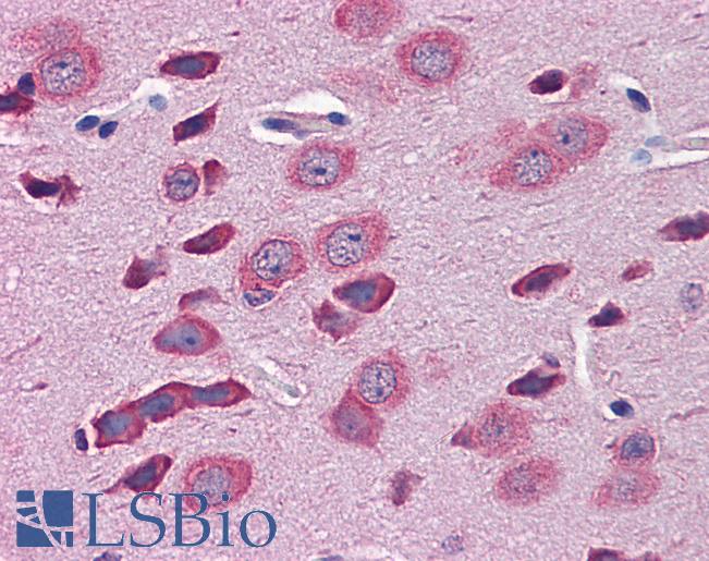 TBR1 Antibody - Anti-TBR1 antibody IHC of mouse brain. Immunohistochemistry of formalin-fixed, paraffin-embedded tissue after heat-induced antigen retrieval. Antibody concentration 5 ug/ml.  This image was taken for the unconjugated form of this product. Other forms have not been tested.