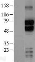 TBR1 Protein - Western validation with an anti-DDK antibody * L: Control HEK293 lysate R: Over-expression lysate