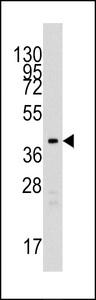 TBRG1 Antibody - Western blot of anti-TBRG1 antibody in mouse kidney tissue lysates (35 ug/lane). TBRG1(arrow) was detected using the purified antibody.
