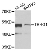 TBRG1 Antibody - Western blot analysis of extracts of various cells.