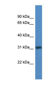 TBRG1 Antibody - TBRG1 antibody Western blot of Fetal Lung lysate.  This image was taken for the unconjugated form of this product. Other forms have not been tested.