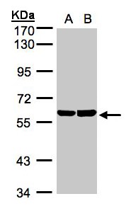 TBRG4 Antibody - Sample (30 ug whole cell lysate). A: A431, B: Hep G2 . 7.5% SDS PAGE. TBRG4 antibody diluted at 1:1000