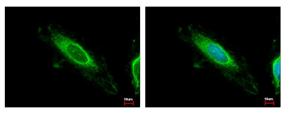 TBRG4 Antibody - TBRG4 antibody detects TBRG4 protein at mitochondria by immunofluorescent analysis. HeLa cells were fixed in ice-cold MeOH for 5 min. TBRG4 protein stained by TBRG4 antibody diluted at 1:500. 