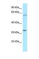 TBRG4 Antibody - TBRG4 antibody Western blot of MCF7 Cell lysate. Antibody concentration 1 ug/ml.  This image was taken for the unconjugated form of this product. Other forms have not been tested.