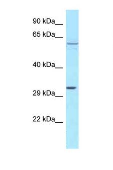 TBRG4 Antibody - TBRG4 antibody Western blot of MCF7 Cell lysate. Antibody concentration 1 ug/ml.  This image was taken for the unconjugated form of this product. Other forms have not been tested.