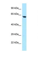 TBRG4 Antibody - TBRG4 antibody Western blot of Jurkat Cell lysate. Antibody concentration 1 ug/ml.  This image was taken for the unconjugated form of this product. Other forms have not been tested.