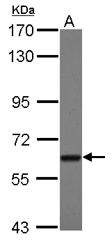 TBRG4 Antibody - Sample (30 ug of whole cell lysate) A: A431 7.5% SDS PAGE TBRG4 antibody diluted at 1:1000