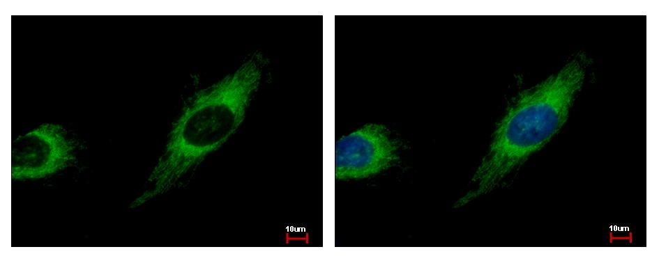TBRG4 Antibody - TBRG4 antibody detects TBRG4 protein at mitochondria by immunofluorescent analysis. HeLa cells were fixed in 4% paraformaldehyde at RT for 15 min. TBRG4 protein stained by TBRG4 antibody diluted at 1:500.