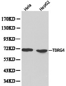 TBRG4 Antibody - Western blot of TBRG4 pAb in extracts from Hela and HepG2 cells.