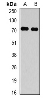 TBRG4 Antibody - Western blot analysis of TBRG4 expression in HeLa (A); HepG2 (B) whole cell lysates.