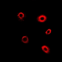 TBRG4 Antibody - Immunofluorescent analysis of TBRG4 staining in HeLa cells. Formalin-fixed cells were permeabilized with 0.1% Triton X-100 in TBS for 5-10 minutes and blocked with 3% BSA-PBS for 30 minutes at room temperature. Cells were probed with the primary antibody in 3% BSA-PBS and incubated overnight at 4 deg C in a humidified chamber. Cells were washed with PBST and incubated with a DyLight 594-conjugated secondary antibody (red) in PBS at room temperature in the dark.