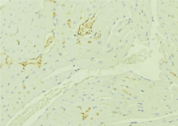 TBRG4 Antibody - 1:100 staining mouse liver tissue by IHC-P. The sample was formaldehyde fixed and a heat mediated antigen retrieval step in citrate buffer was performed. The sample was then blocked and incubated with the antibody for 1.5 hours at 22°C. An HRP conjugated goat anti-rabbit antibody was used as the secondary.
