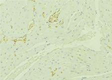 TBRG4 Antibody - 1:100 staining mouse liver tissue by IHC-P. The sample was formaldehyde fixed and a heat mediated antigen retrieval step in citrate buffer was performed. The sample was then blocked and incubated with the antibody for 1.5 hours at 22°C. An HRP conjugated goat anti-rabbit antibody was used as the secondary.