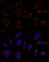 TBRG4 Antibody - Immunofluorescence analysis of L929 cells using TBRG4 Polyclonal Antibody at dilution of 1:100.Blue: DAPI for nuclear staining.