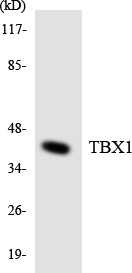 TBX1 Antibody - Western blot analysis of the lysates from 293 cells using TBX1 antibody.