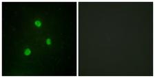 TBX1 Antibody - Immunofluorescence analysis of A549 cells, using TBX1 Antibody. The picture on the right is blocked with the synthesized peptide.