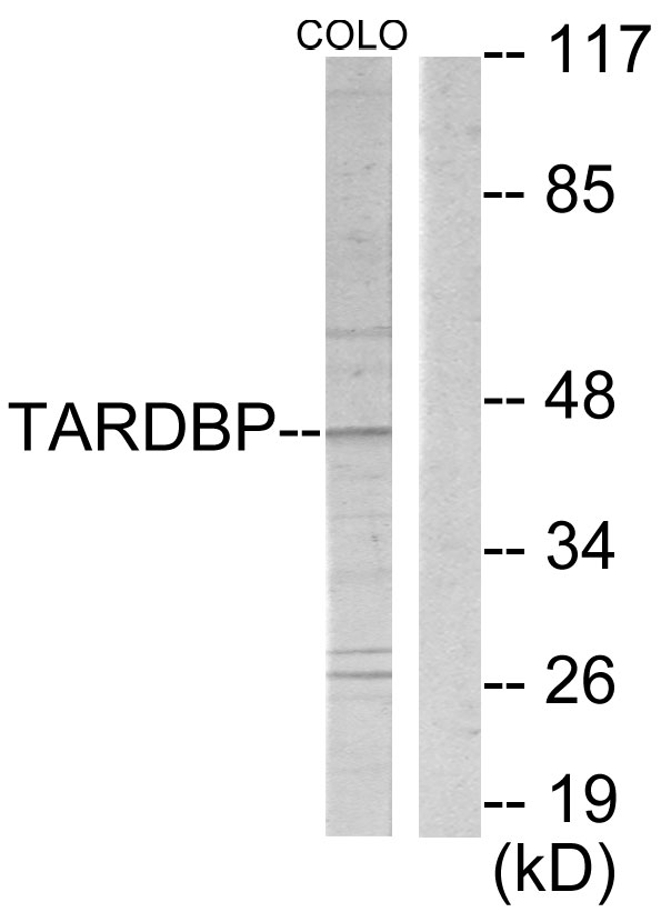 TBX1 Antibody - Western blot analysis of lysates from COLO205 cells, using TBX1 Antibody. The lane on the right is blocked with the synthesized peptide.