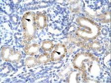 TBX1 Antibody - TBX1 antibody ARP33399_T100-NP_542378-TBX1 (T-box 1) Antibody was used in IHC to stain formalin-fixed, paraffin-embedded human kidney.  This image was taken for the unconjugated form of this product. Other forms have not been tested.