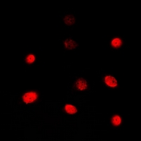 TBX1 Antibody - Immunofluorescent analysis of TBX1 staining in Jurkat cells. Formalin-fixed cells were permeabilized with 0.1% Triton X-100 in TBS for 5-10 minutes and blocked with 3% BSA-PBS for 30 minutes at room temperature. Cells were probed with the primary antibody in 3% BSA-PBS and incubated overnight at 4 deg C in a humidified chamber. Cells were washed with PBST and incubated with a DyLight 594-conjugated secondary antibody (red) in PBS at room temperature in the dark. DAPI was used to stain the cell nuclei (blue).