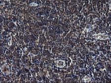 TBX1 Antibody - IHC of paraffin-embedded Human lymph node tissue using anti-TBX1 mouse monoclonal antibody. (Heat-induced epitope retrieval by 1 mM EDTA in 10mM Tris, pH8.5, 120°C for 3min).