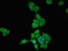 TBX1 Antibody - Immunofluorescent analysis of PC3 cells at a dilution of 1:100 and Alexa Fluor 488-congugated AffiniPure Goat Anti-Rabbit IgG(H+L)