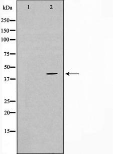 TBX1 Antibody - Western blot analysis on COLO205 cell lysates using TBX1 antibody. The lane on the left is treated with the antigen-specific peptide.