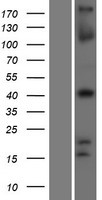 TBX1 Protein - Western validation with an anti-DDK antibody * L: Control HEK293 lysate R: Over-expression lysate