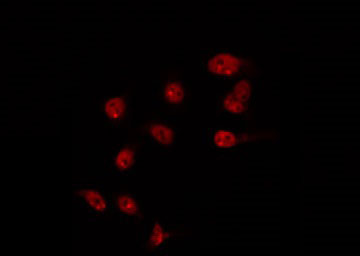 TBX10 Antibody - Staining HT29 cells by IF/ICC. The samples were fixed with PFA and permeabilized in 0.1% Triton X-100, then blocked in 10% serum for 45 min at 25°C. The primary antibody was diluted at 1:200 and incubated with the sample for 1 hour at 37°C. An Alexa Fluor 594 conjugated goat anti-rabbit IgG (H+L) Ab, diluted at 1/600, was used as the secondary antibody.