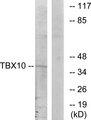 TBX10 Antibody - Western blot analysis of extracts from HT-29 cells, using TBX10 antibody.