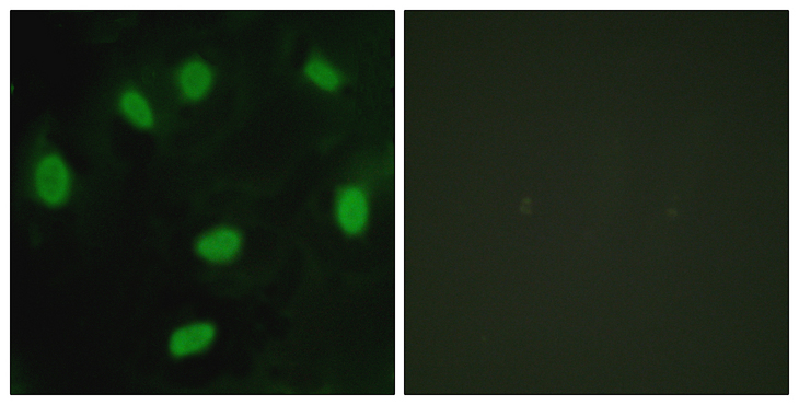 TBX15+18 Antibody - Immunofluorescence analysis of HeLa cells, using TBX15/18 Antibody. The picture on the right is blocked with the synthesized peptide.