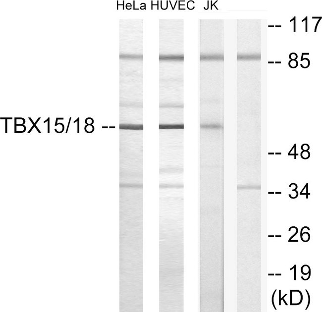 TBX15+18 Antibody - Western blot analysis of lysates from HUVEC, HeLa, and Jurkat cells, using TBX15/18 Antibody. The lane on the right is blocked with the synthesized peptide.