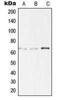 TBX15+18 Antibody - Western blot analysis of TBX15/18 expression in Jurkat (A); HepG2 (B); LOVO (C) whole cell lysates.