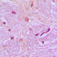 TBX15+18 Antibody - Immunohistochemical analysis of TBX15/18 staining in human brain formalin fixed paraffin embedded tissue section. The section was pre-treated using heat mediated antigen retrieval with sodium citrate buffer (pH 6.0). The section was then incubated with the antibody at room temperature and detected using an HRP conjugated compact polymer system. DAB was used as the chromogen. The section was then counterstained with hematoxylin and mounted with DPX.