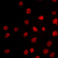 TBX15+18 Antibody - Immunofluorescent analysis of TBX15/18 staining in HepG2 cells. Formalin-fixed cells were permeabilized with 0.1% Triton X-100 in TBS for 5-10 minutes and blocked with 3% BSA-PBS for 30 minutes at room temperature. Cells were probed with the primary antibody in 3% BSA-PBS and incubated overnight at 4 C in a humidified chamber. Cells were washed with PBST and incubated with a DyLight 594-conjugated secondary antibody (red) in PBS at room temperature in the dark. DAPI was used to stain the cell nuclei (blue).