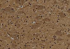 TBX15+18 Antibody - 1:100 staining rat brain tissue by IHC-P. The sample was formaldehyde fixed and a heat mediated antigen retrieval step in citrate buffer was performed. The sample was then blocked and incubated with the antibody for 1.5 hours at 22°C. An HRP conjugated goat anti-rabbit antibody was used as the secondary.