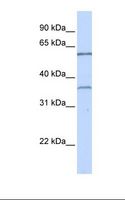 TBX15 Antibody - Jurkat cell lysate. Antibody concentration: 1.0 ug/ml. Gel concentration: 12%.  This image was taken for the unconjugated form of this product. Other forms have not been tested.
