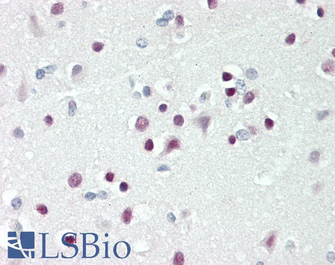 TBX15 Antibody - Human Brain, Cortex: Formalin-Fixed, Paraffin-Embedded (FFPE).  This image was taken for the unconjugated form of this product. Other forms have not been tested.