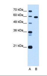 TBX15 Antibody - Lane A: Marker. Lane B: Jurkat cell lysate. Antibody concentration: 1.25 ug/ml. Gel concentration: 12%.  This image was taken for the unconjugated form of this product. Other forms have not been tested.