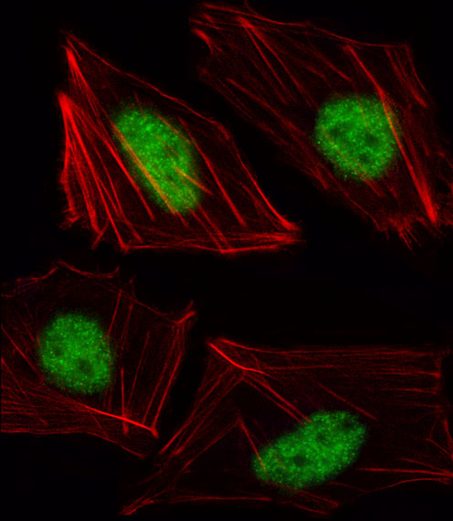 TBX15 Antibody - Fluorescent image of HUVEC cell stained with TBX15 Antibody. HUVEC cells were fixed with 4% PFA (20 min), permeabilized with Triton X-100 (0.1%, 10 min), then incubated with TBX15 primary antibody (1:25, 1 h at 37°C). For secondary antibody, Alexa Fluor 488 conjugated donkey anti-rabbit antibody (green) was used (1:400, 50 min at 37°C). Cytoplasmic actin was counterstained with Alexa Fluor 555 (red) conjugated Phalloidin (7units/ml, 1 h at 37°C). TBX15 immunoreactivity is localized to Nucleus significantly.