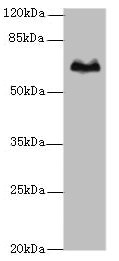 TBX15 Antibody - Western blot All lanes: TBX15 antibody at 5µg/ml + Hela whole cell lysate Secondary Goat polyclonal to rabbit IgG at 1/10000 dilution Predicted band size: 66, 55 kDa Observed band size: 66 kDa