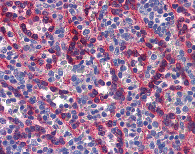 TBX18 Antibody - Anti-TBX18 antibody IHC of human spleen. Immunohistochemistry of formalin-fixed, paraffin-embedded tissue after heat-induced antigen retrieval. Antibody concentration 5 ug/ml.  This image was taken for the unconjugated form of this product. Other forms have not been tested.