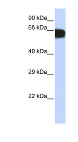 TBX18 Antibody - TBX18 antibody Western blot of Placenta lysate. This image was taken for the unconjugated form of this product. Other forms have not been tested.