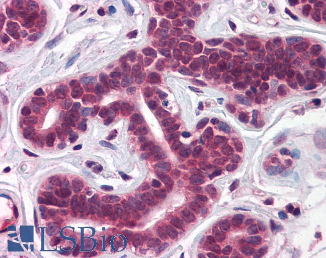 TBX18 Antibody - Anti-TBX18 antibody IHC of human breast. Immunohistochemistry of formalin-fixed, paraffin-embedded tissue after heat-induced antigen retrieval. Antibody concentration 5 ug/ml.  This image was taken for the unconjugated form of this product. Other forms have not been tested.