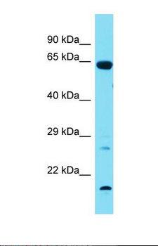 TBX18 Antibody - Western blot of Rat Lung. Tbx18 antibody dilution 1.0 ug/ml.  This image was taken for the unconjugated form of this product. Other forms have not been tested.