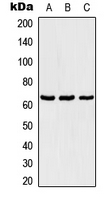 TBX18 Antibody - Western blot analysis of TBX18 expression in Jurkat (A); NIH3T3 (B); PC12 (C) whole cell lysates.