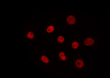 TBX18 Antibody - Staining HeLa cells by IF/ICC. The samples were fixed with PFA and permeabilized in 0.1% Triton X-100, then blocked in 10% serum for 45 min at 25°C. The primary antibody was diluted at 1:200 and incubated with the sample for 1 hour at 37°C. An Alexa Fluor 594 conjugated goat anti-rabbit IgG (H+L) Ab, diluted at 1/600, was used as the secondary antibody.