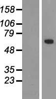 TBX18 Protein - Western validation with an anti-DDK antibody * L: Control HEK293 lysate R: Over-expression lysate