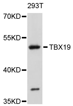 TBX19 / TPIT Antibody - Western blot analysis of extracts of 293T cells, using TBX19 antibody at 1:1000 dilution. The secondary antibody used was an HRP Goat Anti-Rabbit IgG (H+L) at 1:10000 dilution. Lysates were loaded 25ug per lane and 3% nonfat dry milk in TBST was used for blocking. An ECL Kit was used for detection and the exposure time was 30s.